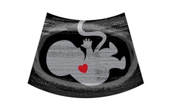 خواص خاویار برای باروری؛ تقویت طبیعی شانس فرزندآوری در آقایان و بانوان