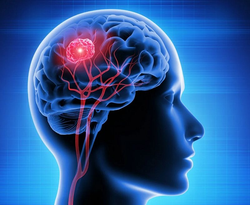 به مغزمون یه خاویار بدهکاریم!|خواص بی نظیر خاویار برای مغز